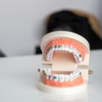 Invisalign: Alternativa invizibilă pentru un zâmbet perfect